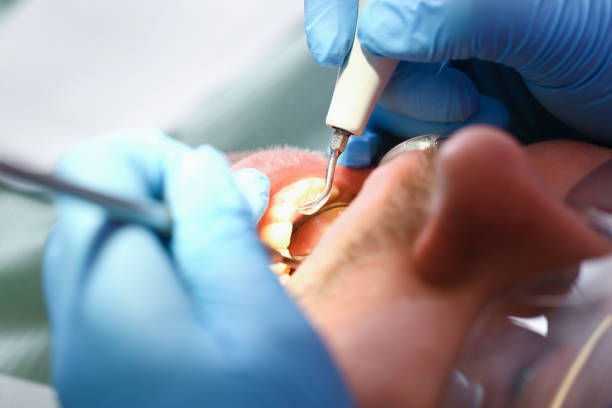 Best Urgent Tooth Repair  in Unt Vernon, MO