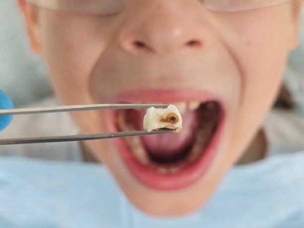 Best Dentist for Dental Trauma  in Unt Vernon, MO